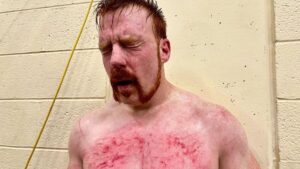 Sheamus Has No Regrets Over Missing Out On IC Title