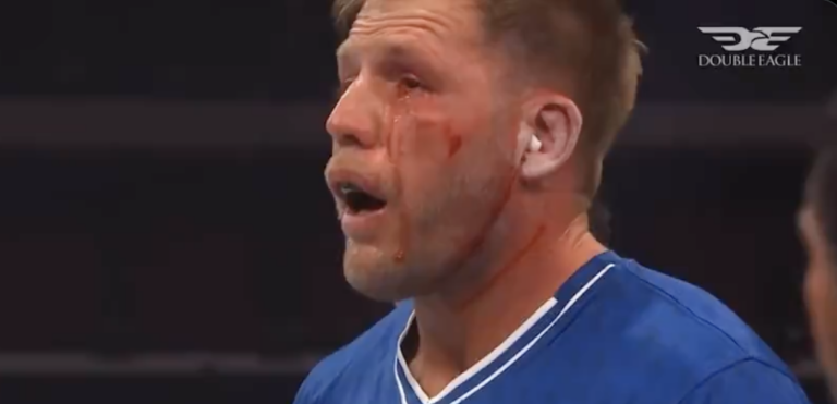 Jake Hager’s Power Slap Eye Injury Is a Warning the Whole Business Should Heed